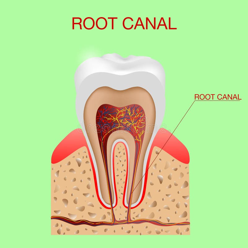 Root canal. Dental infographic. The structure inside and the tooth diagram and chart illustration vector vector illustration