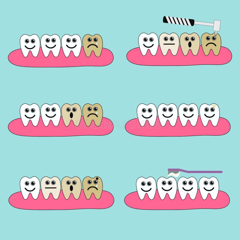 Set of healthy and diseased teeth with different facial expressions. Disease and treatment of caries. Oral hygiene. Vector. vector illustration