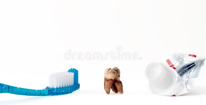 Single extracted molar tooth with caries decay and filling with tooth paste and empty tube of tooth paste. White background with. Copy space stock image