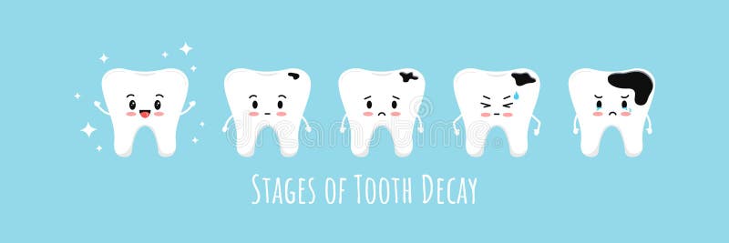 Stages of emoji tooth decay vector icon set. vector illustration