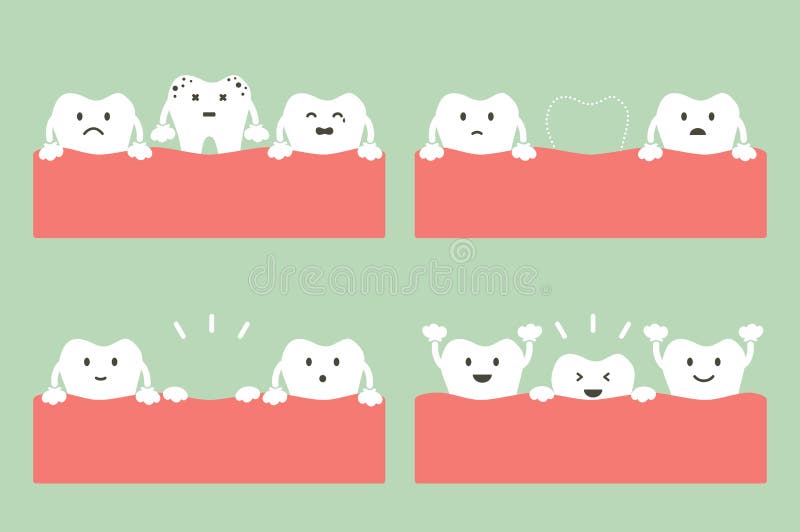 Step of caries to first teeth. Tooth cartoon vector flat style for design - step of caries to first teeth, dental care concept stock illustration