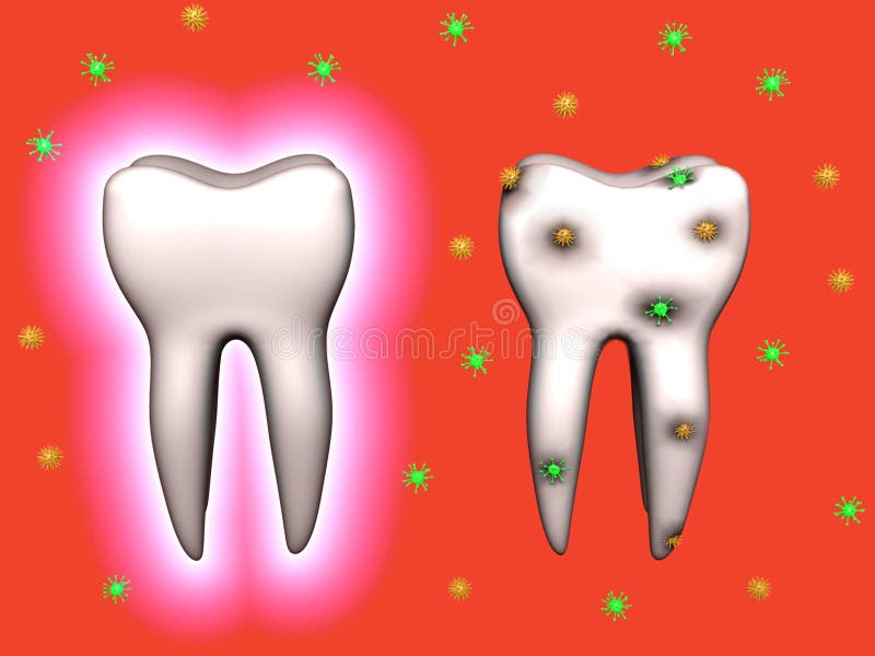 Teeth. Protected and with caries. A 3d image of teeth. One iis protected, another with caries vector illustration