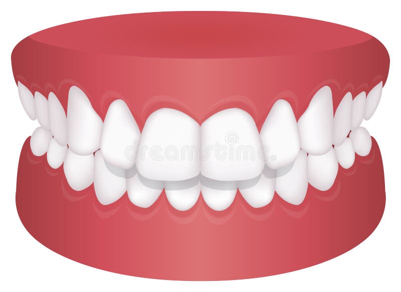 Teeth trouble  bite type  vector illustration //Overbite Back teeth. Teeth trouble  bite type  vector illustration /Overbite , Back teeth stock illustration