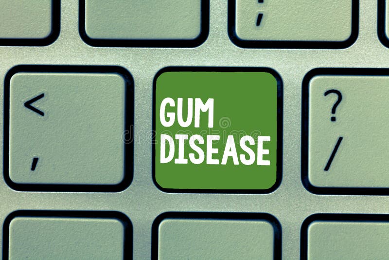 Text sign showing Gum Disease. Conceptual photo Inflammation of the soft tissue Gingivitis Periodontitis.  royalty free stock image
