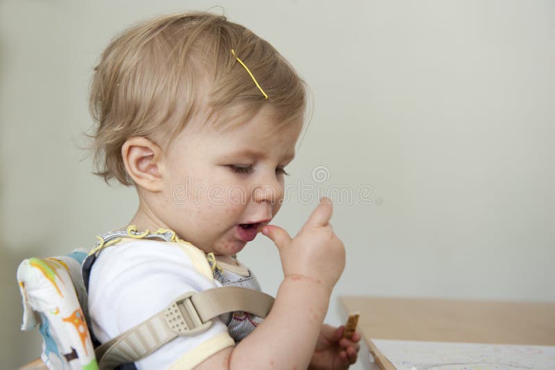 Toddler with hand , foot and mouth disease. Indoors stock image