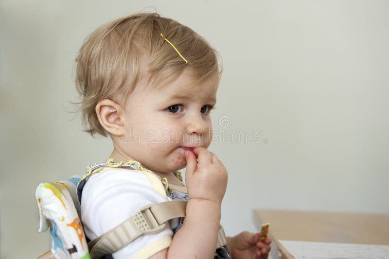 Toddler with hand , foot and mouth disease. Indoors royalty free stock image