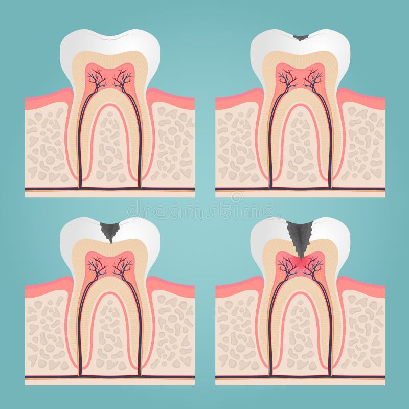 Tooth anatomy royalty free illustration