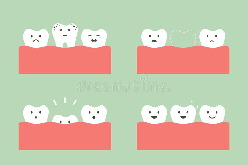 Step of caries to first teeth. Tooth cartoon vector flat style for design - step of caries to first teeth, dental care concept vector illustration