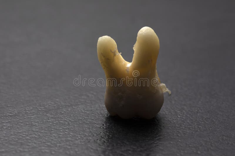 Torn out human tooth. Root up. Tooth close-up stock photo