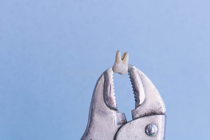 A torn tooth is clamped in large pliers on a blue medical background. Copyspace top view royalty free stock photography