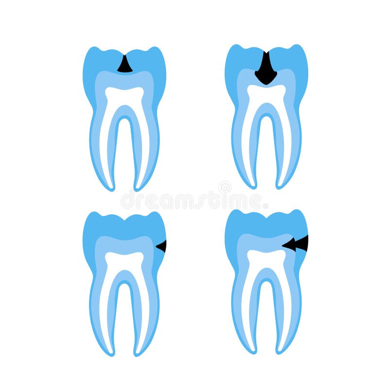 Vector isolated illustration of tooth royalty free illustration