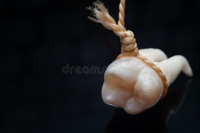 A wisdom tooth royalty free stock image A wisdom tooth royalty free stock image