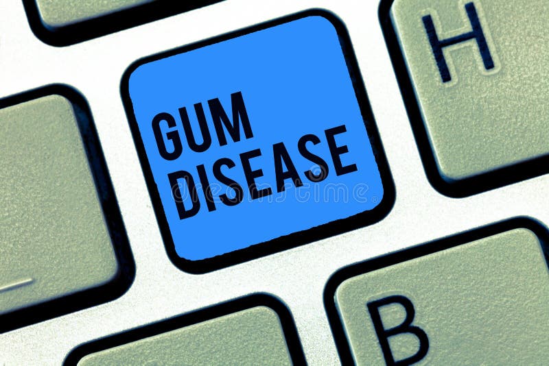 Word writing text Gum Disease. Business concept for Inflammation of the soft tissue Gingivitis Periodontitis.  stock photos