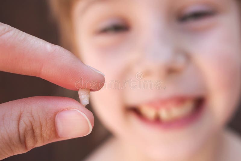 At 6 years old child has lost the baby tooth. The girl is holding the tooth in his hand.  stock photography