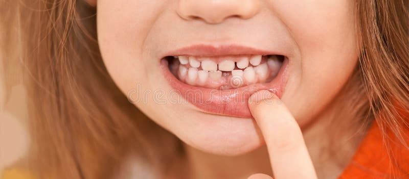 Young girl point on milk tooth. Baby losing teeth royalty free stock images