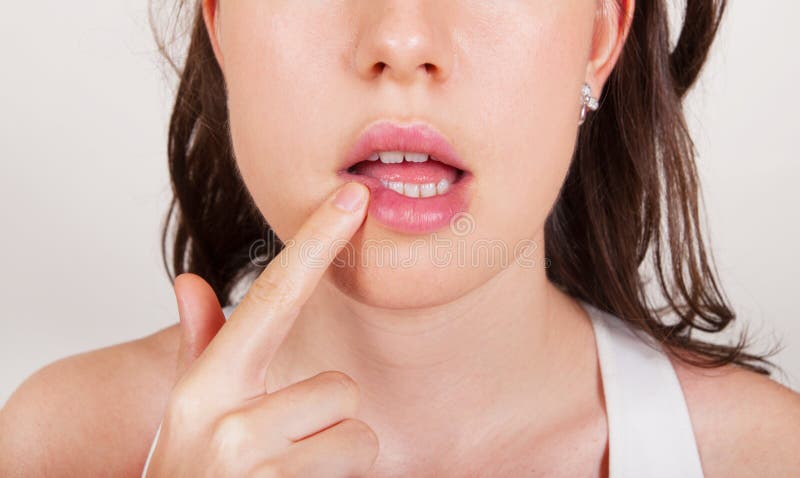 Young woman examining herpes in her face royalty free stock photo