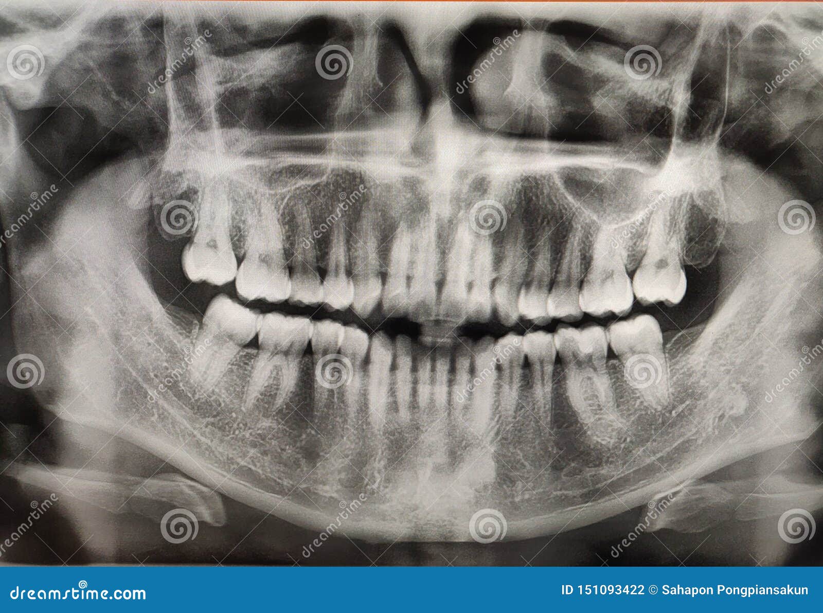 Как называется снимок. Длиннофокусная рентгенография зубов. Зубы человека панорамный снимок. Снимки панорамные здоровых зубов.