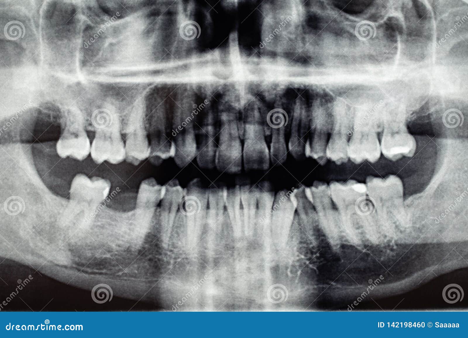фото задних зубов