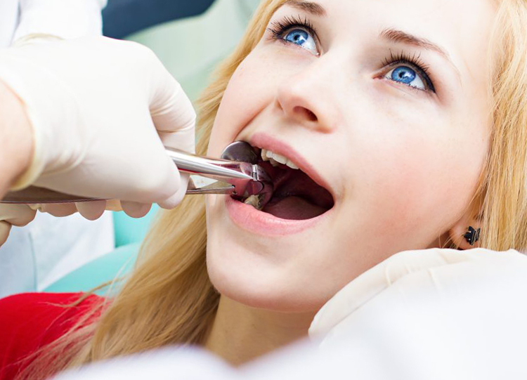 8 причин, когда нужно удалять ретинированные и дистопированные зубы