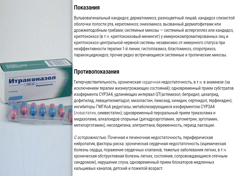 Комплексное лечение молочницы у женщин схема лечения