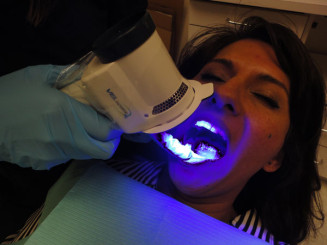 velscope exam for oral cancer on woman