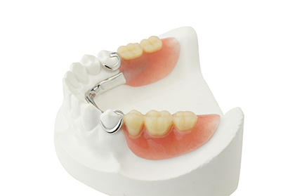 Tooth Loss Option:  Partial dentures to replace missing teeth
