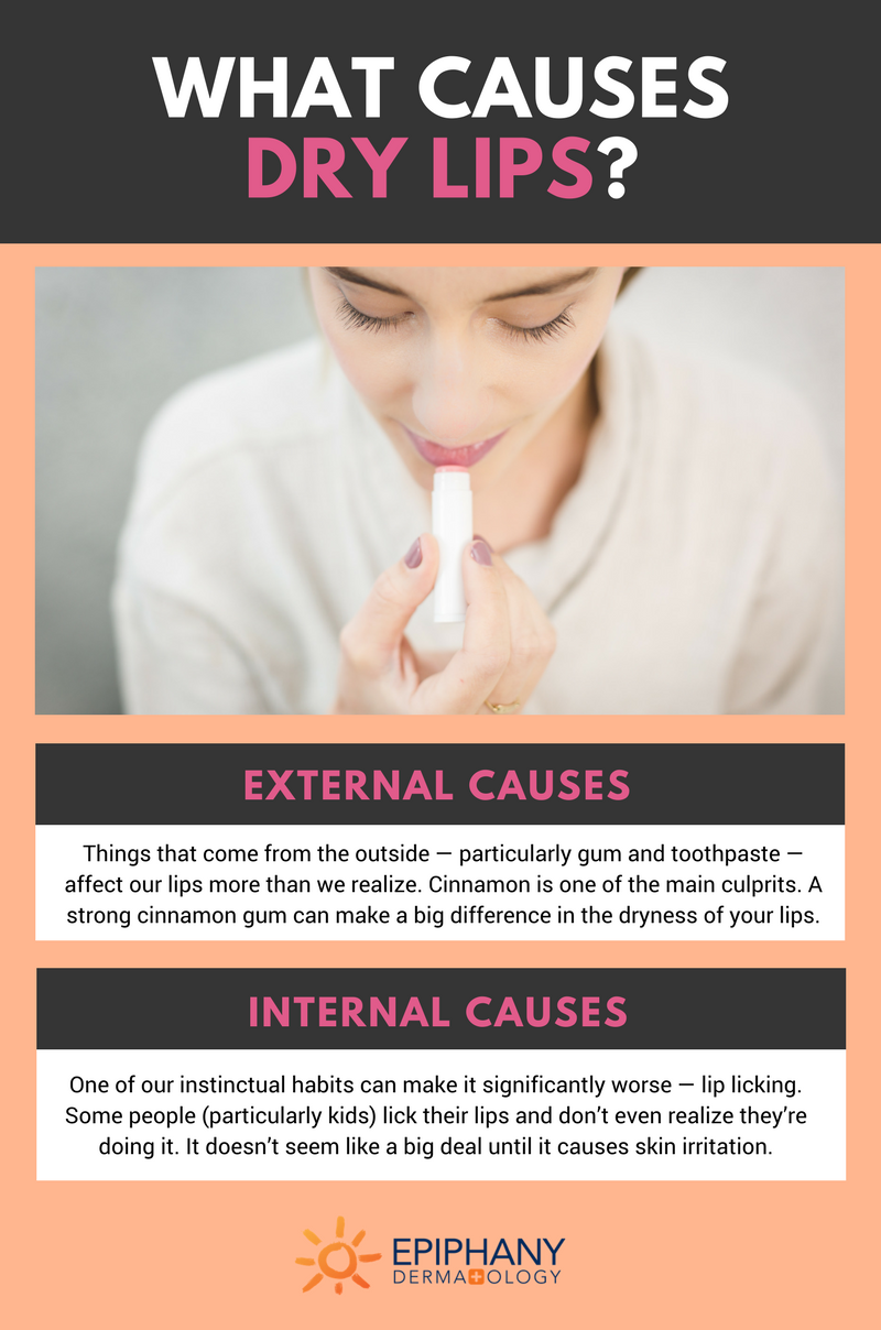 What Causes Dry Lips