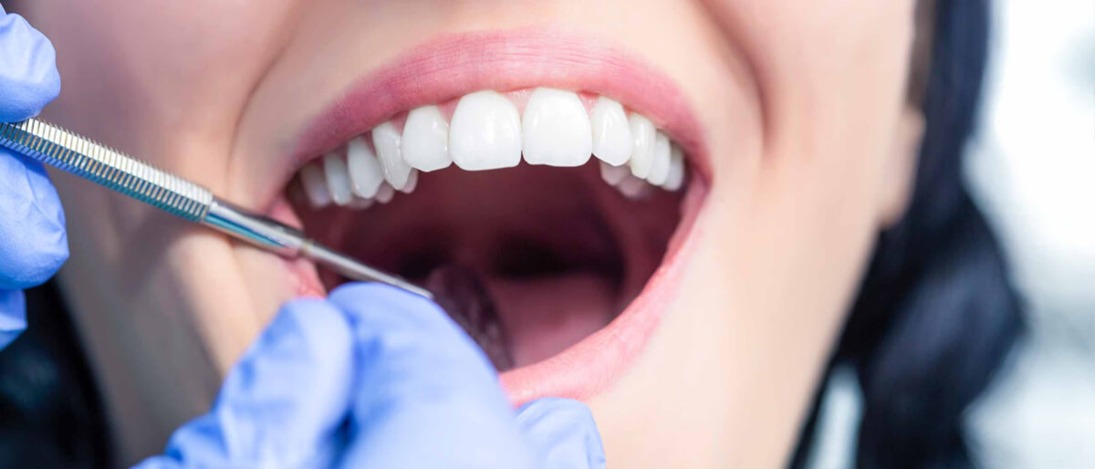 Tooth extraction. Ретинированного дистопированного зуба. Ретенированные и дистопированные зубы. Удаление ретенированного зуба.