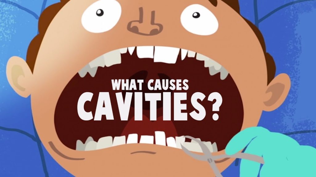 What Causes Cavities