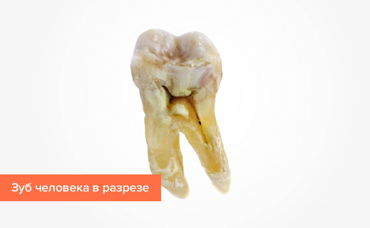 Фото зуба человека в разрезе