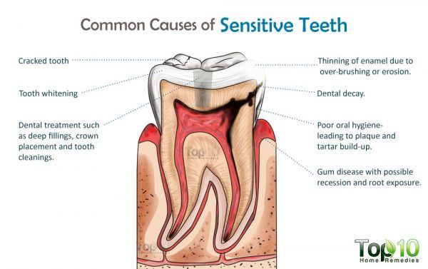 sensitive teeth