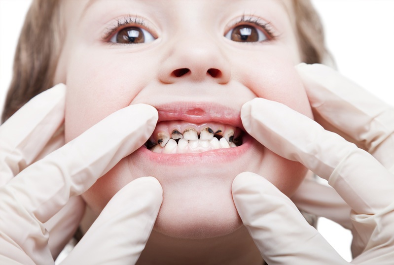 Строение молочного зуба у детей