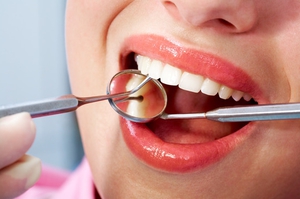 Гнойная гранулема зуба-лечение