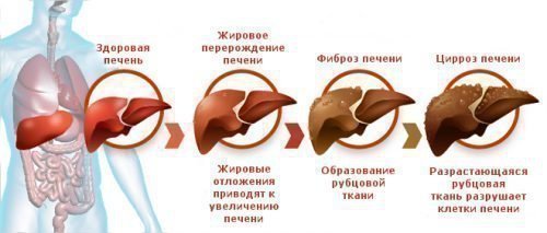 Проблемы с печенью