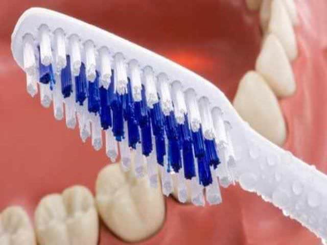  чистка ортодонтических конструкций