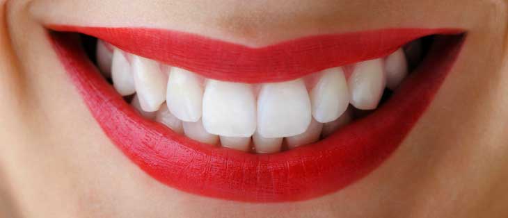 Что нужно знать про отбеливание зубов с пломбами