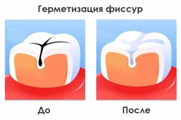 Какие зубы меняются у детей на коренные схема и в каком возрасте фото